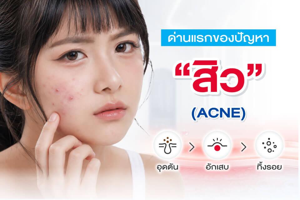 สิว รอยดำ รอยแดง ต่างกันอย่างไร? ดูแลแบบไหนถึงเห็นผล