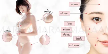 ฉีดไขมัน
