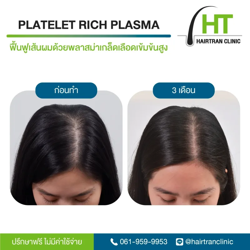Before & After