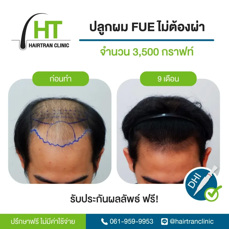 Before & After