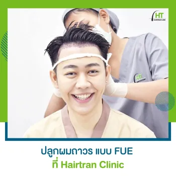 ศัลยกรรมปลูกผมแบบ FUE