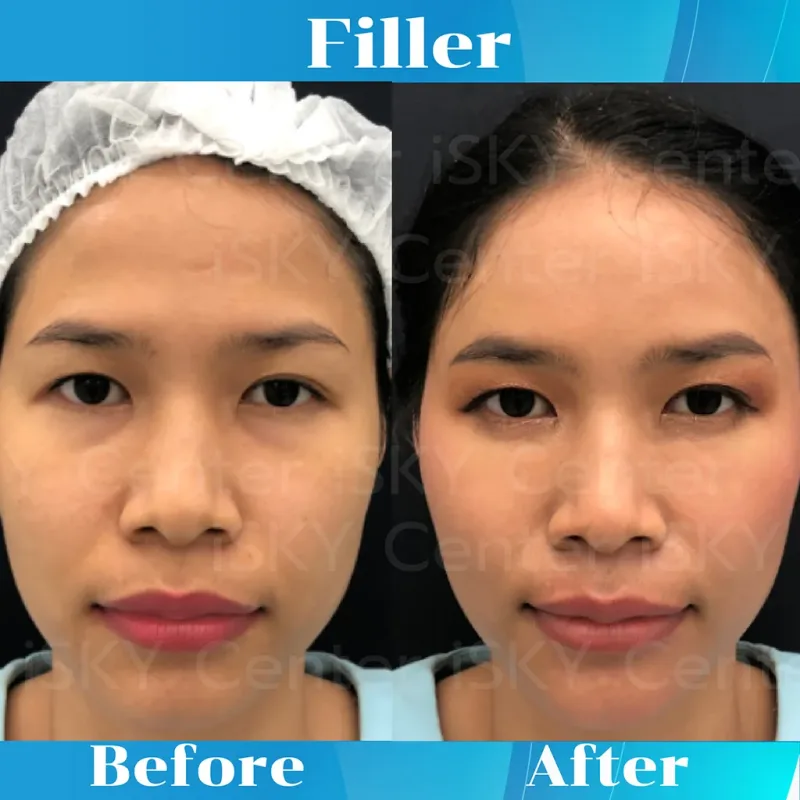 Before & After