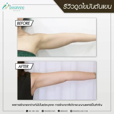 หลัง