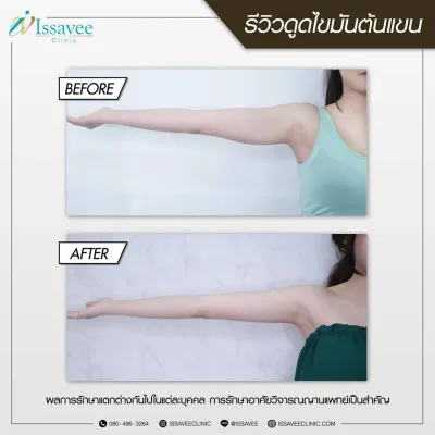 หลัง