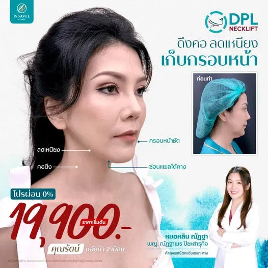 รายละเอียดโปรโมชั่น โปรแกรม DPL NeckLift ของ Issavee Clinic