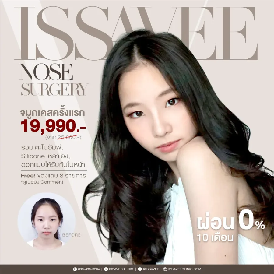 ศัลยกรรมจมูก 19,990 บาท พร้อมของแถม 8 รายการ‼️