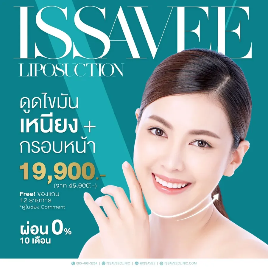 โปรดูดไขมันเหนียง+กรอบหน้า 19,900 ไม่จำกัดซีซี + ของแถม 12 รายการ