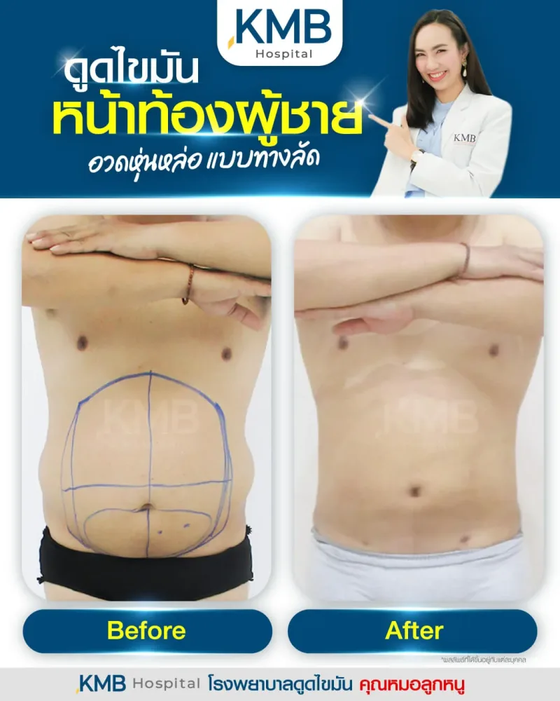 Before & After