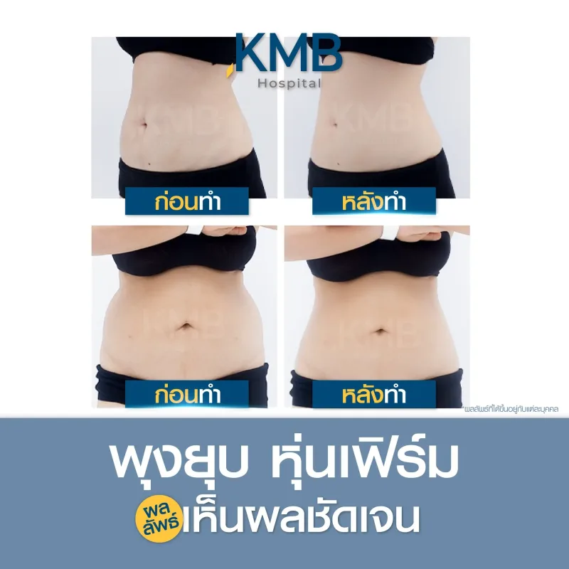 Before & After