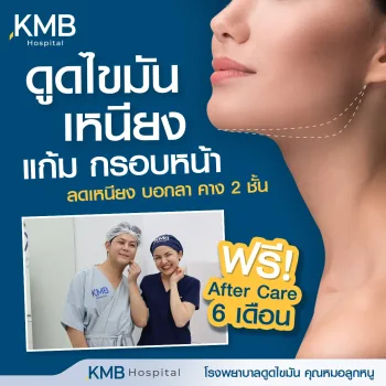 ดูดไขมันเหนียง
