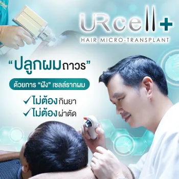 ปลูกผมแบบไม่ผ่าตัด