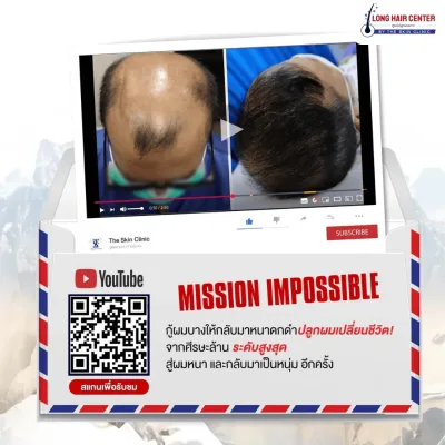 หลัง