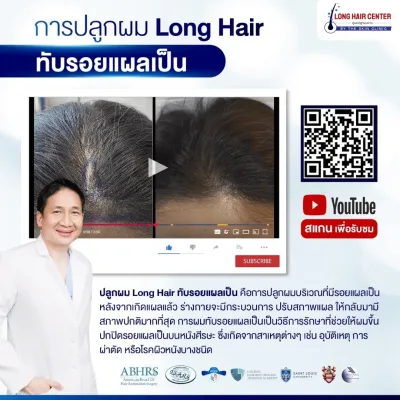 Before and after Long Hair transplant over a scar