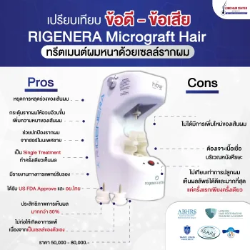 Rigenera Microgaft Hair Transplant ปลูกผมระดับไมโครกราฟต์