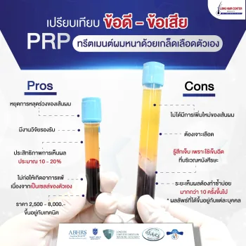 ฉีด PRP กระตุ้นรากผม