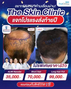 The Skin Clinic แจกโปรปลูกผมส่งท้ายปี