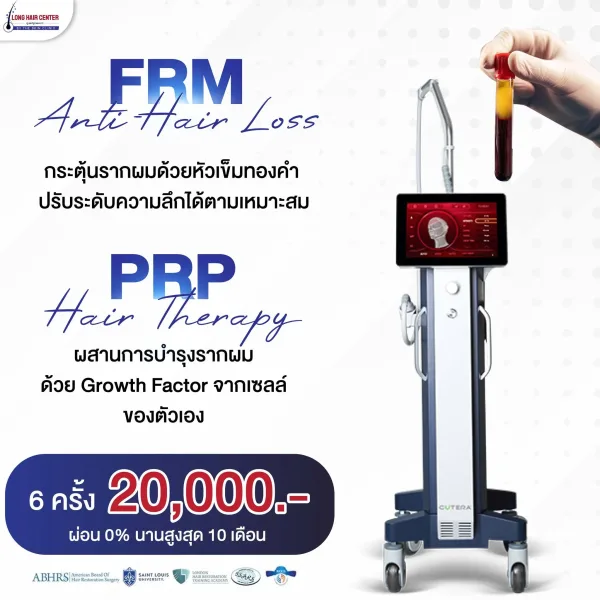รายละเอียดโปรโมชั่น FRM Anti-Hair Loss สร้างเส้นผมเกิดใหม่ด้วยคลื่น RF พลังงานคลื่นวิทยุ