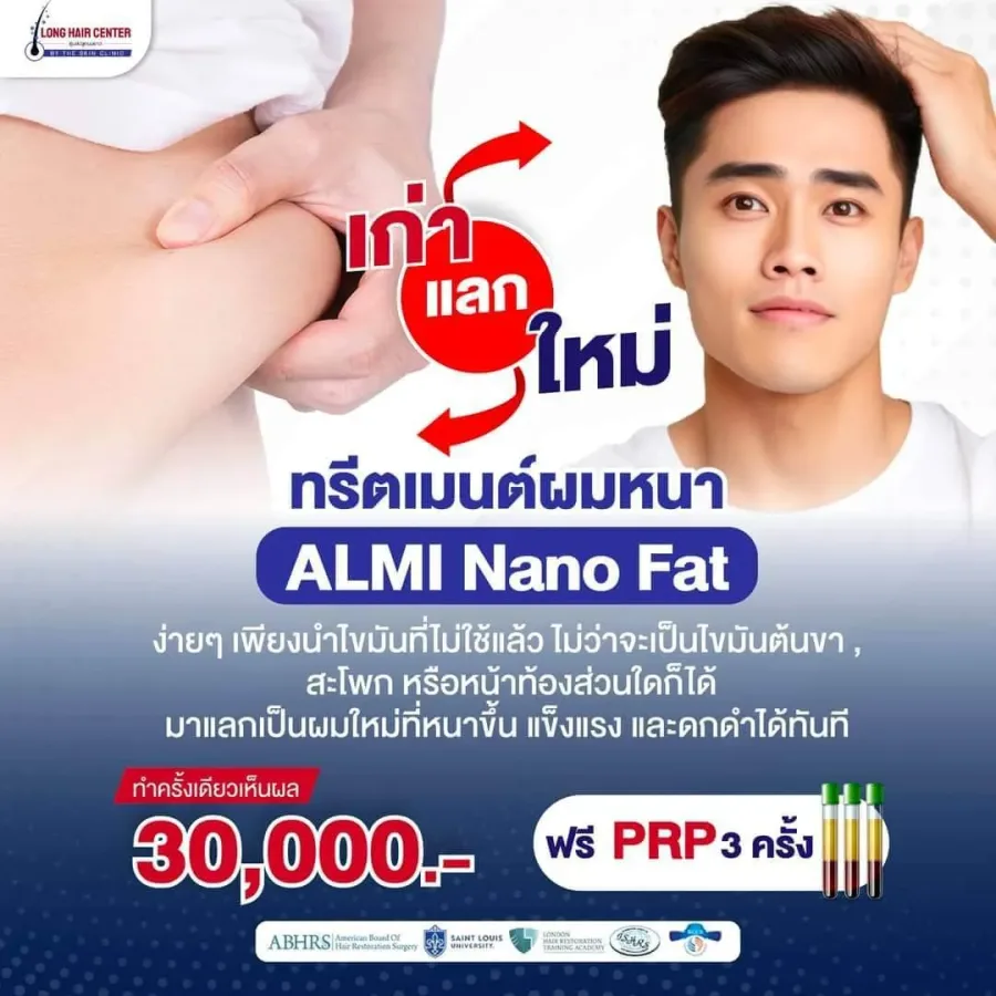 รายละเอียดโปรโมชั่น ALMI กระตุ้นรากผมด้วยไขมัน