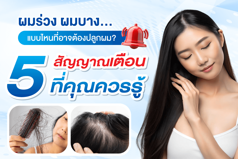 ผมร่วง ผมบาง แบบไหนที่อาจต้องปลูกผม? 5 สัญญาณเตือนที่คุณควรรู้
