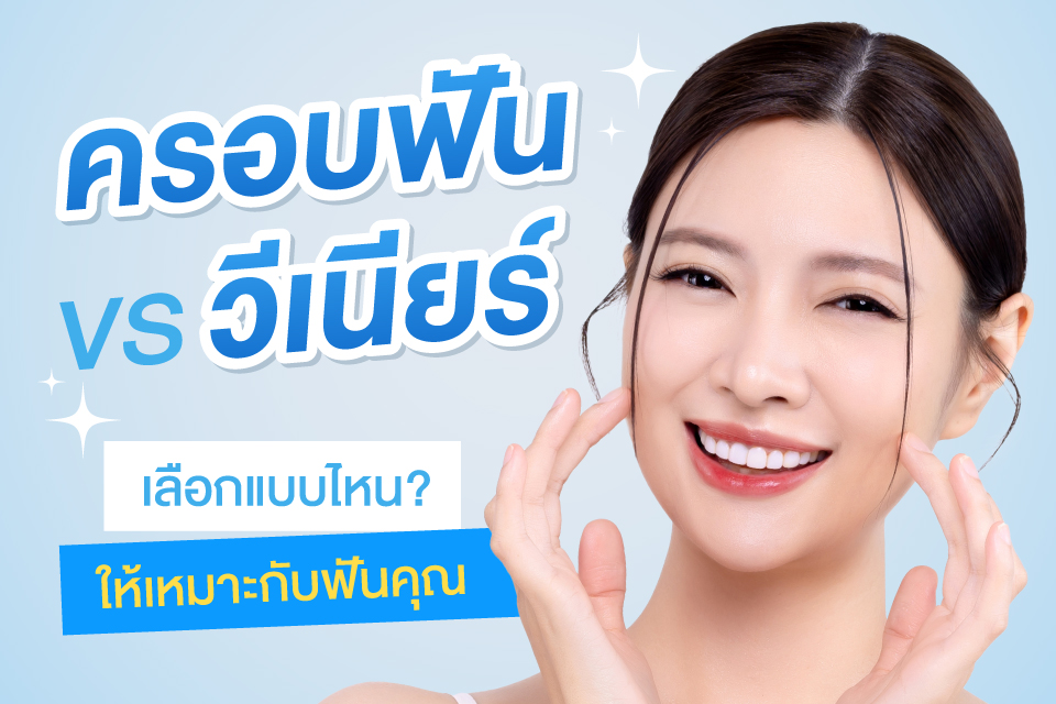 วีเนียร์ vs ครอบฟัน เลือกแบบไหนให้เหมาะกับฟันคุณ