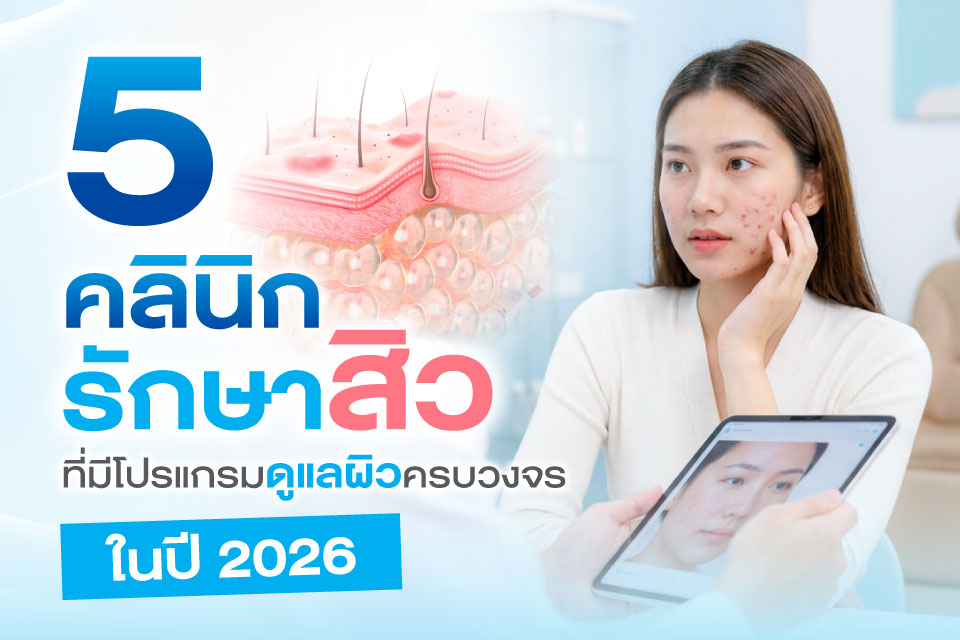 5 คลินิกรักษาสิวที่มีโปรแกรมดูแลผิวครบวงจรในปี 2026