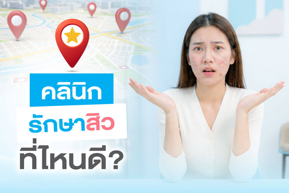 5 คลินิกรักษาสิวที่มีโปรแกรมดูแลผิวครบวงจรในปี 2026