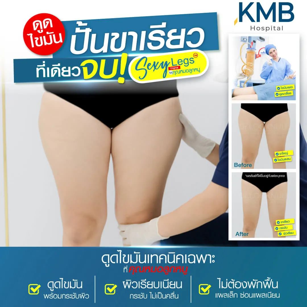 Before - Liposuction