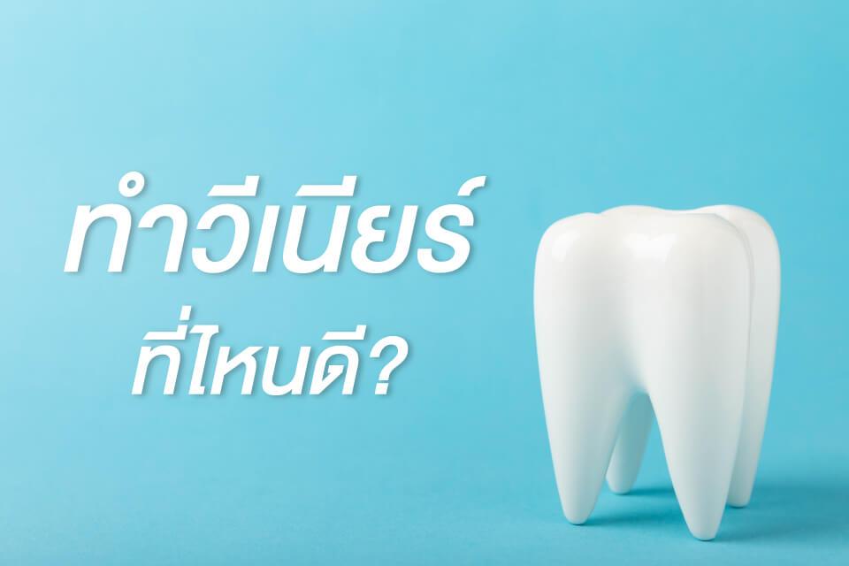 อยากทำวีเนียร์ให้ฟันขาวเรียงสวยห้ามพลาด! อัปเดต 10 คลินิกทำวีเนียร์ ปี 2025
