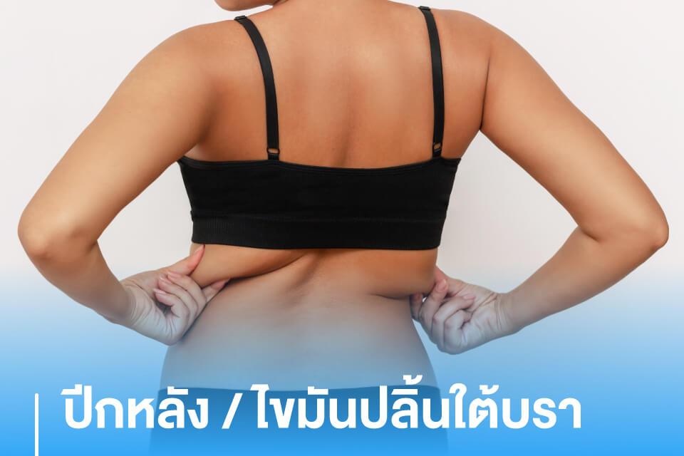 ไขความลับ 5 จุด "ดูดไขมัน" ที่หลายคนอาจยังไม่เคยรู้ กู้หุ่นเป๊ะปังแบบคาดไม่ถึง