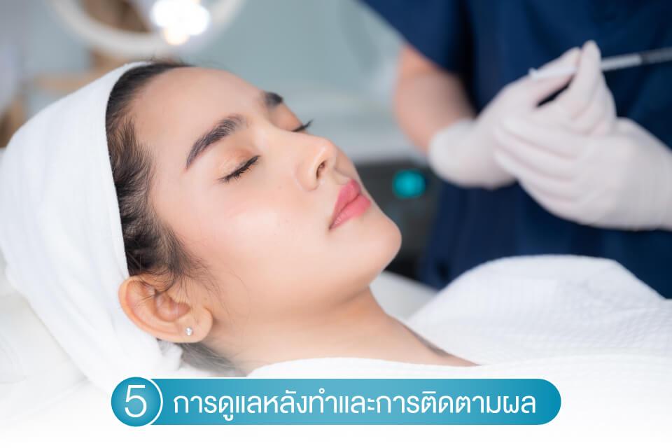 เลือกคลินิกทำ Radiesse ที่ไหนดี? 5 สิ่งที่ต้องรู้ก่อนตัดสินใจ