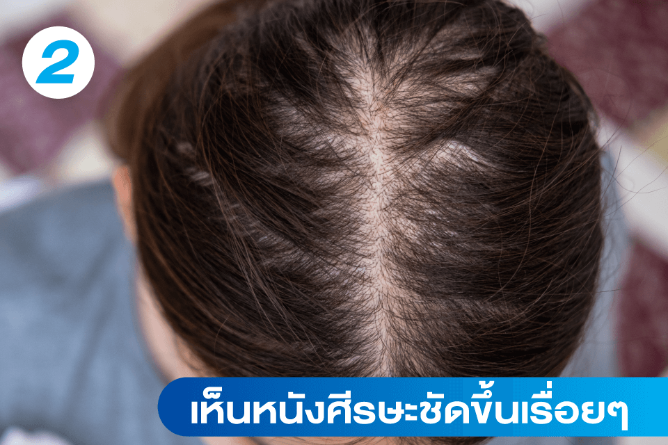 ผมร่วง-ผมบาง-แบบไหนที่อาจต้องปลูกผม-5-สัญญาณเตือนที่คุณควรรู้