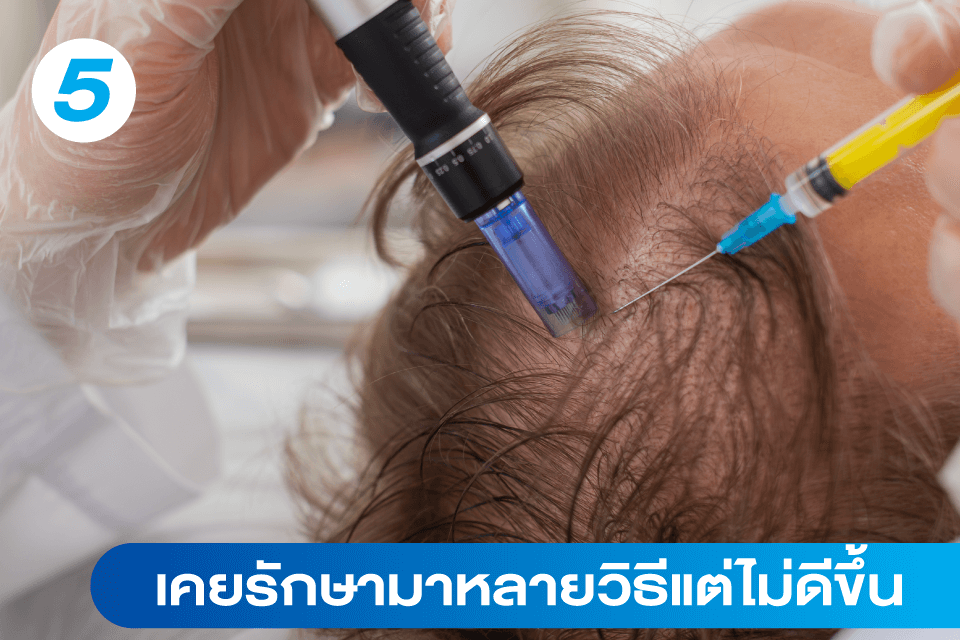 ผมร่วง-ผมบาง-แบบไหนที่อาจต้องปลูกผม-5-สัญญาณเตือนที่คุณควรรู้-6