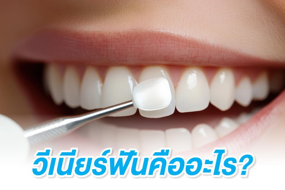 รอยยิ้มที่ผู้ชายยุคใหม่ต้องมี วีเนียร์ฟันเปลี่ยนลุคได้มากกว่าที่คิด