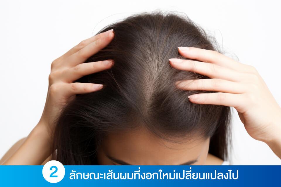 ผมร่วงแบบไม่รู้ตัว 4 สัญญาณเตือนที่ควรระวัง