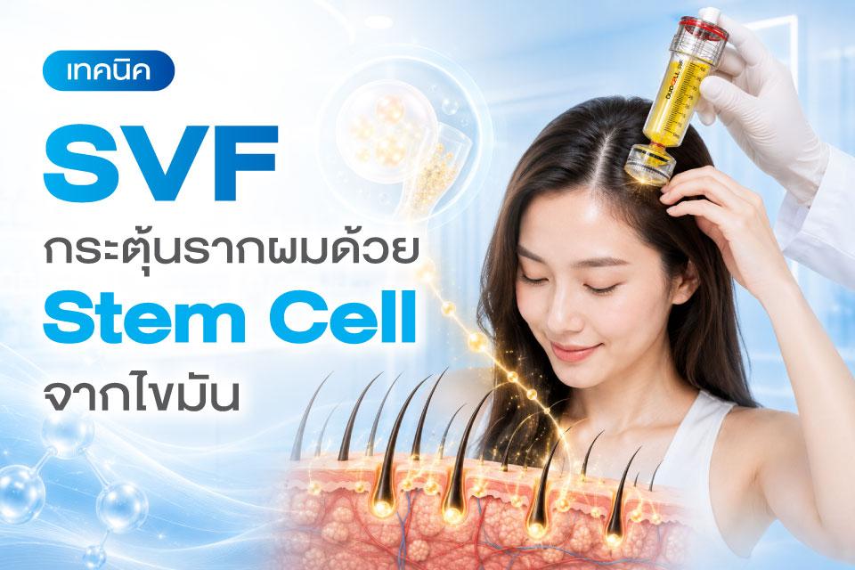 SVF กระตุ้นรากผมด้วย Stem Cell จากไขมัน